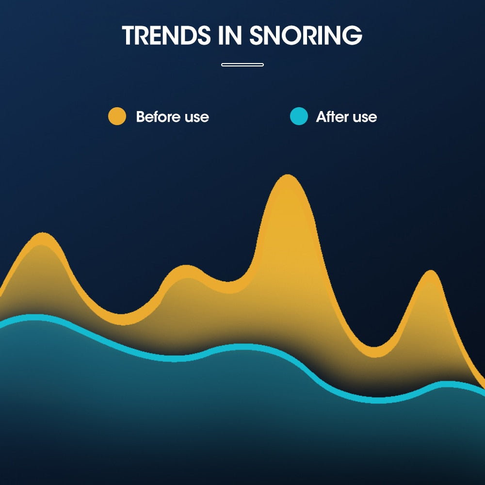 Smart Anti-snoring Device Snoring Stuffy Nose Snored Intelligent Breathing Apparatus Household Sleep Anti-snoring