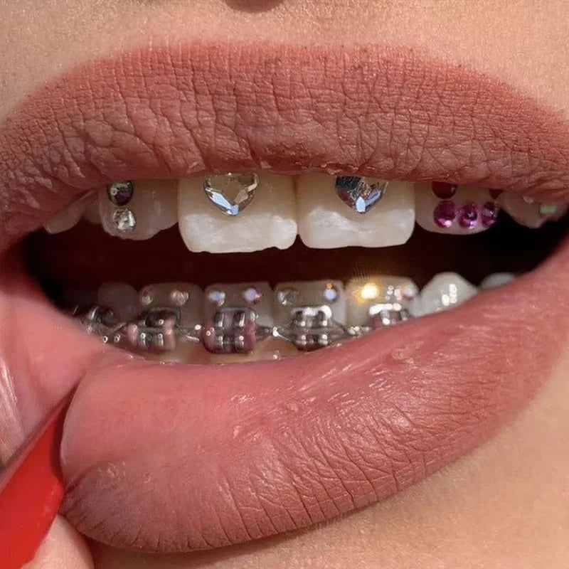 DIY Jewelry Tooth Gem Kit Glue Dental Crystal Decorations Etching Gel