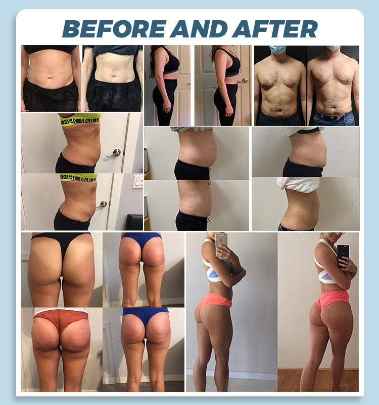 No -Exercise Electromagnetic Body Slimming Build Muscle Stimulate