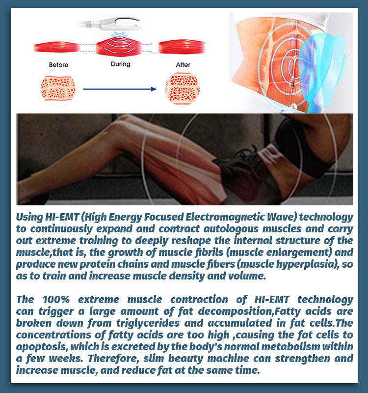 No -Exercise Electromagnetic  Body Slimming Build Muscle Stimulate